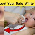infant white tongue