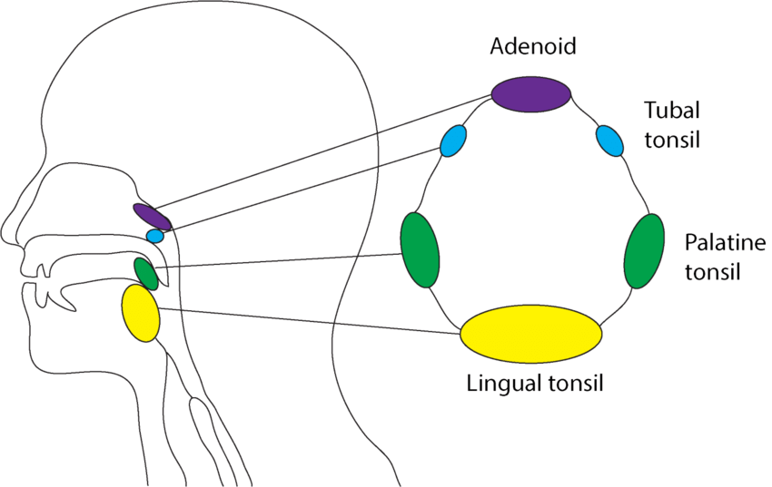 white lumps on tonsils and sore throat